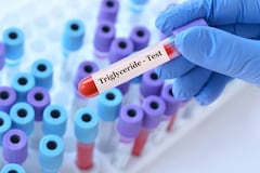 Triglicéridos