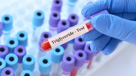 Triglicéridos