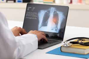 Los pulmones son órganos determinantes para el buen funcionamiento del organismo.